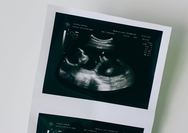 Desmontando el mito del “feto ingeniero” y el estigma sobre el aborto