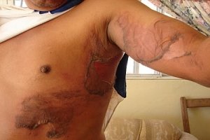 Tortura, práctica recurrente  contra pueblos indígenas en Chiapas