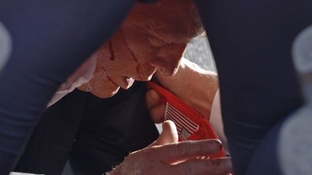 “Me dispararon con una bala que perforó mi oreja derecha”: Trump